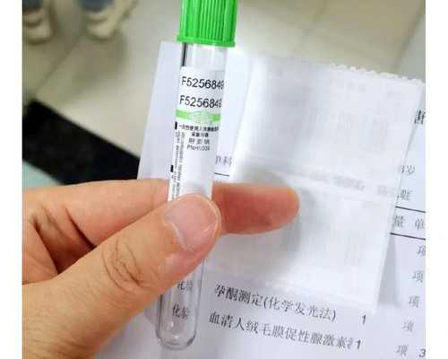 济南供卵试管包男孩价格,济南三代试管包生男孩多少钱